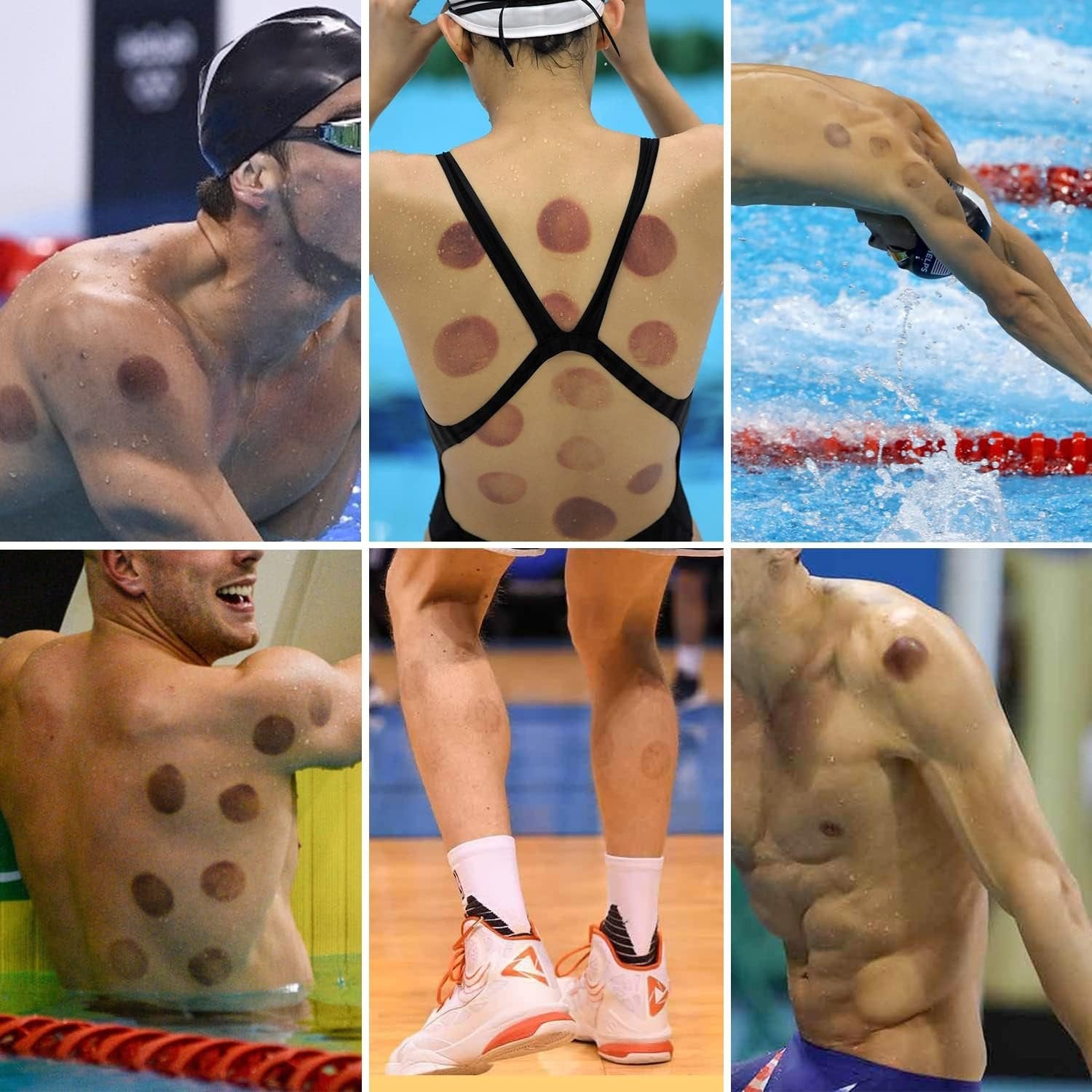 12 Cups Set for Cellulite Cupping Massager – Holistic Wellness Solution