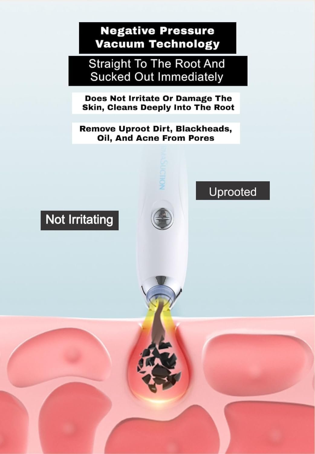 Pore Cleaner ? Deep Cleansing Face Vacuum Suction Tool for Blackheads, Whiteheads, and Skin Exfoliation