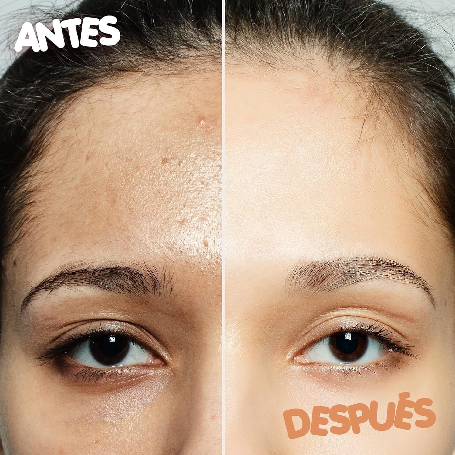 2 SIDE FACIAL CLEANSING BRUSH ? Dual-Sided Brush for Deep Pore Cleansing and Exfoliation