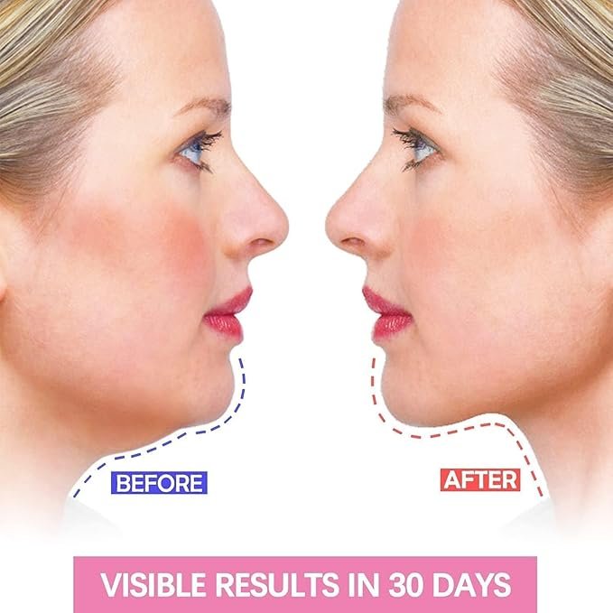 Face Slimming Mask ? V Line Lifting Mask for Double Chin Reduction & Firming | Reusable V-Shaped Face Belt for Women & Men | Skin Tightening Face Lifter