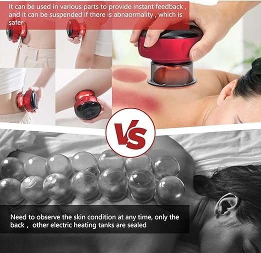 Electric Cupping Therapy Set ? Smart Cupping Massager with Red Light & Adjustable Suction | Rechargeable Body Muscle Relaxation Device for Back, Neck, Shoulder Pain Relief