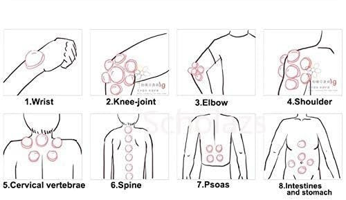 12 Cups Set for Cellulite Cupping Massager – Holistic Wellness Solution