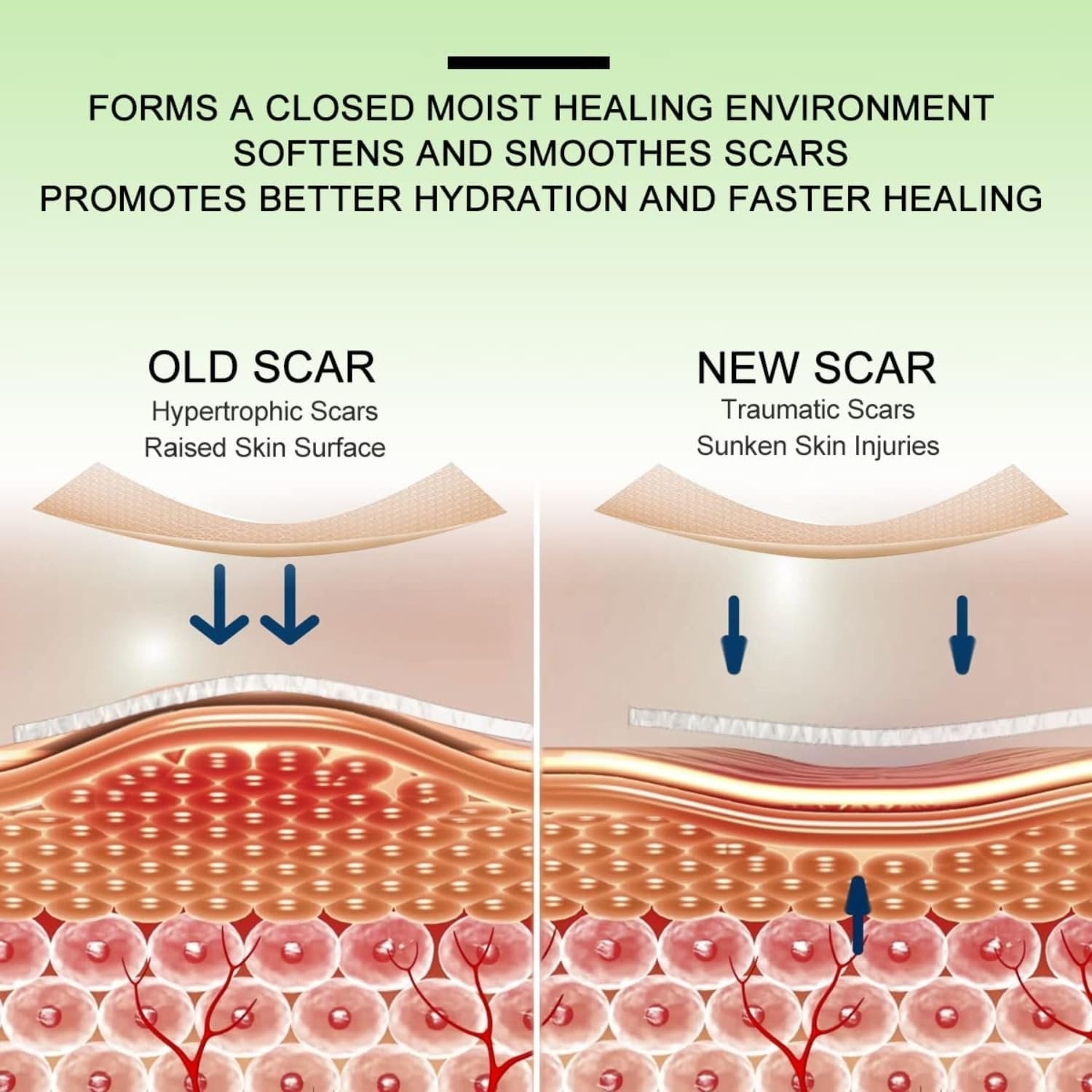 Silicone Gel Strips Patch Tape – Smooth and Secure