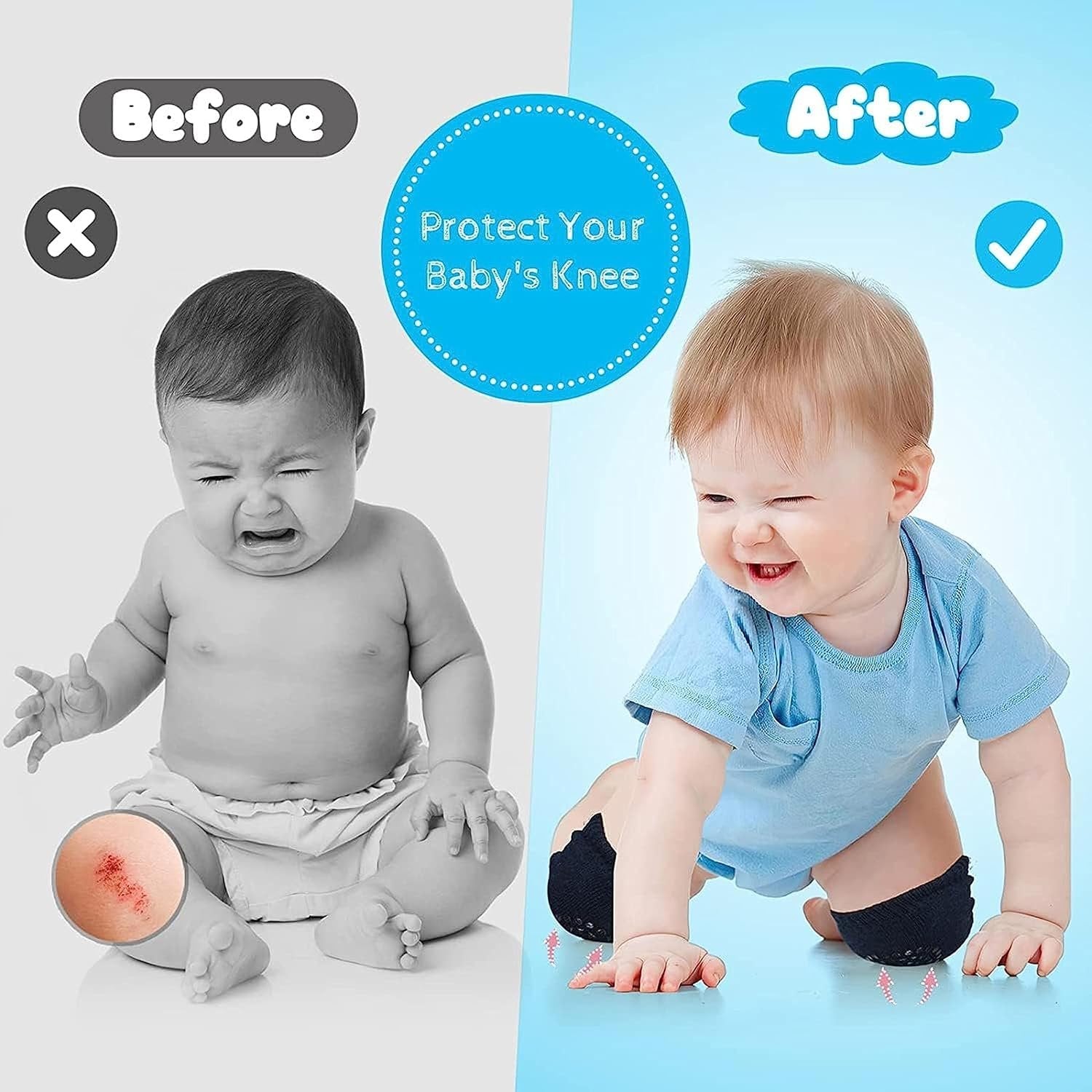 Baby Knee Pad ? Soft & Comfortable Protection for Crawling Infants, Non-Slip Design for Safe Play
