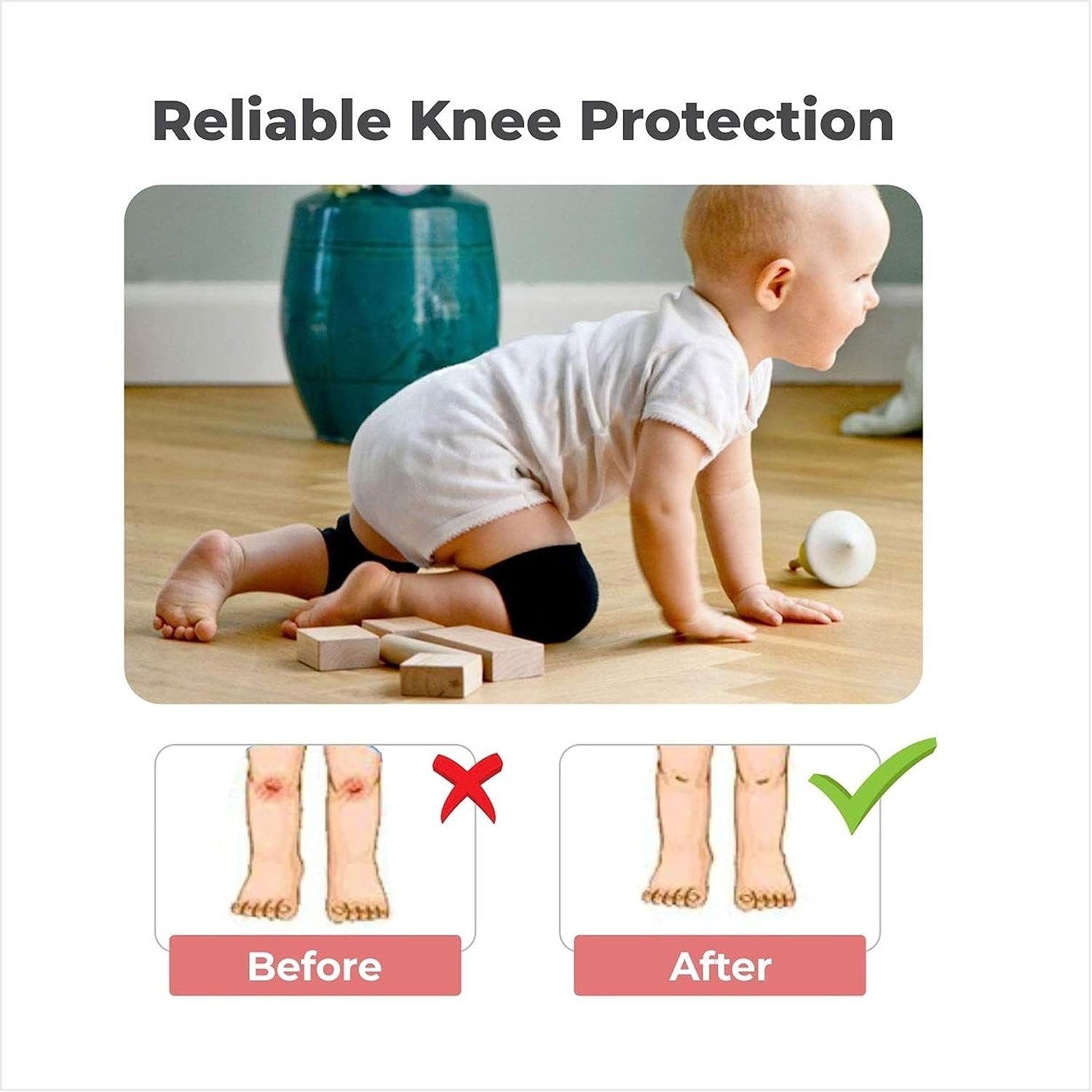 Baby Knee Pad ? Soft & Comfortable Protection for Crawling Infants, Non-Slip Design for Safe Play
