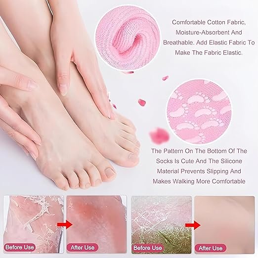 Spa Gel Socks ? Moisturizing Cracked Heel Socks with Gel Lining, Reusable Hydrating Foot Care Socks for Dry Feet, Heels & Callus Repair