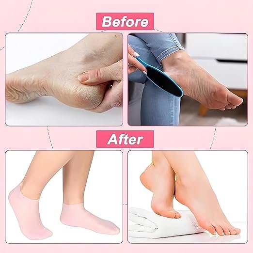 Spa Gel Socks ? Moisturizing Cracked Heel Socks with Gel Lining, Reusable Hydrating Foot Care Socks for Dry Feet, Heels & Callus Repair